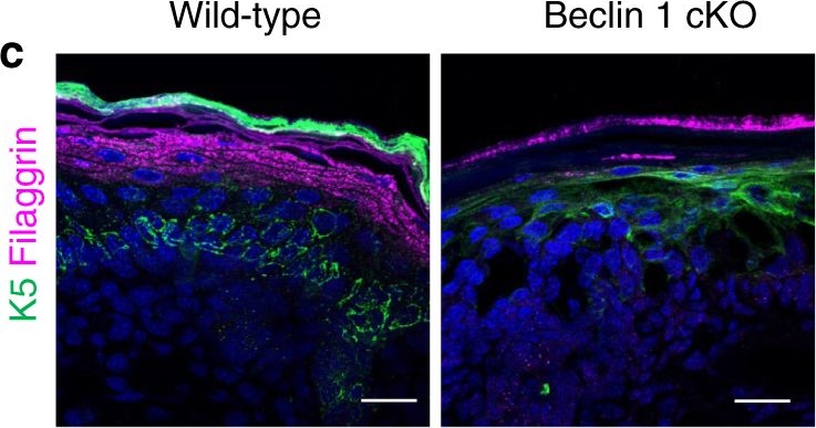 Beclin 1 regulates recycling endosome and is required for skin development in mice.