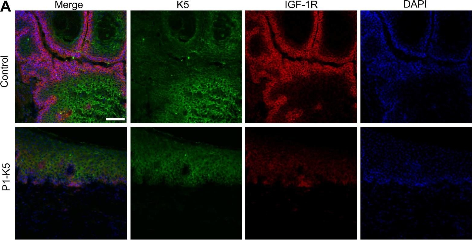 PINCH-1 promotes IGF-1 receptor expression and skin cancer progression through inhibition of the GRB10-NEDD4 complex.