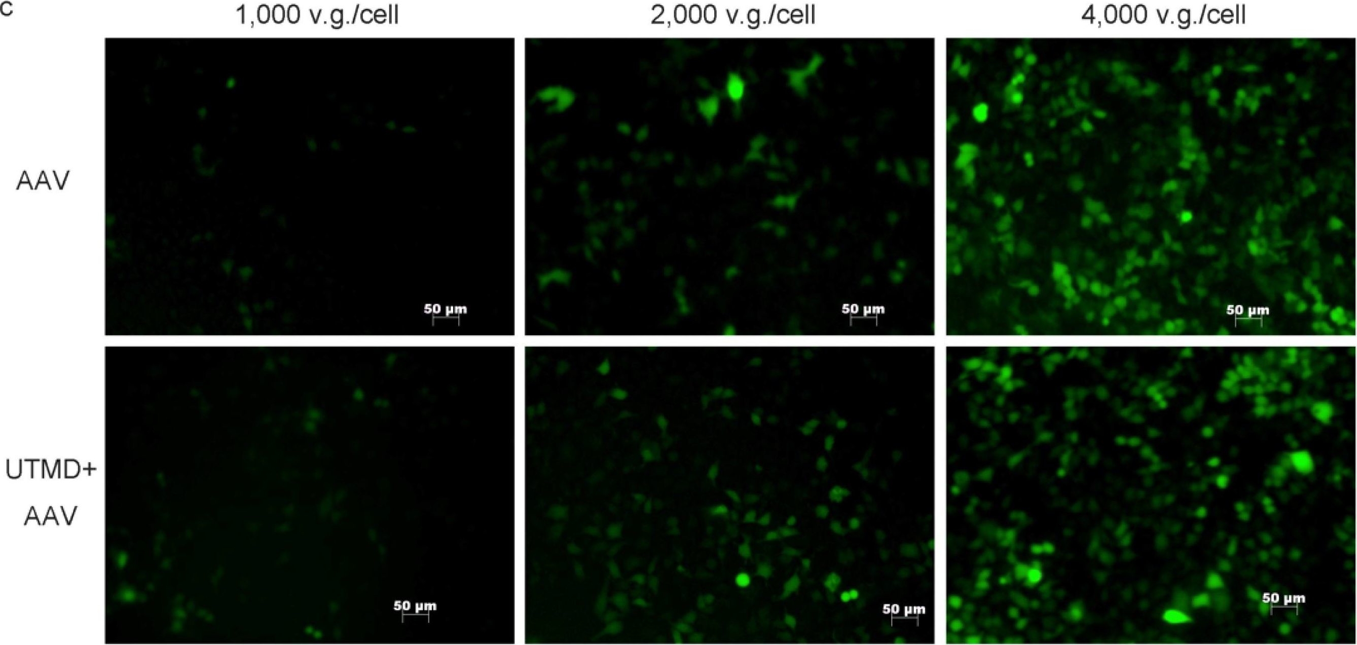 Ultrasound targeted microbubble destruction stimulates cellular endocytosis in facilitation of adeno-associated virus delivery.