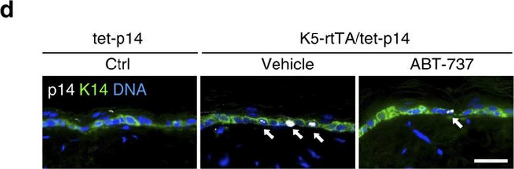 Directed elimination of senescent cells by inhibition of BCL-W and BCL-XL.