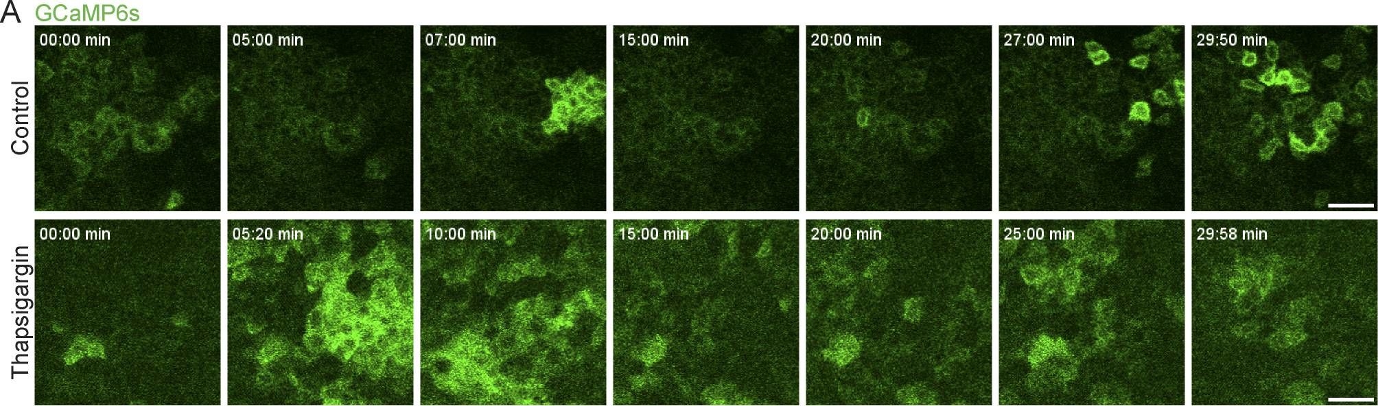 Cell cycle controls long-range calcium signaling in the regenerating epidermis.