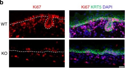 The RNA-binding protein YBX1 regulates epidermal progenitors at a posttranscriptional level.