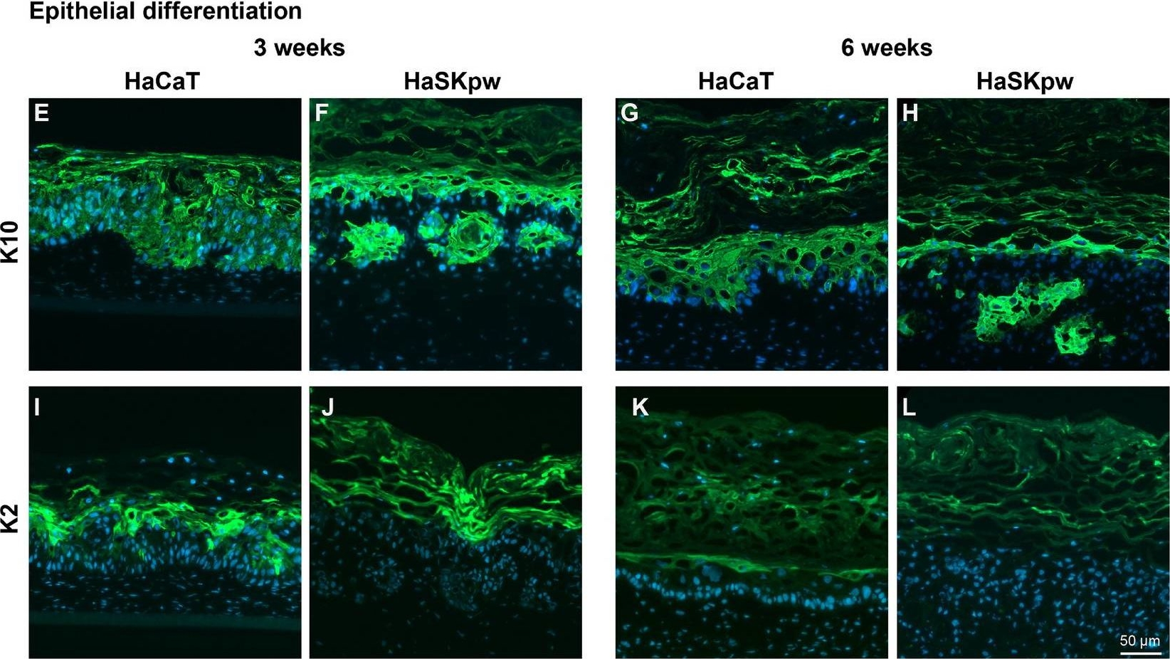 Characterisation of the novel spontaneously immortalized and invasively growing human skin keratinocyte line HaSKpw.