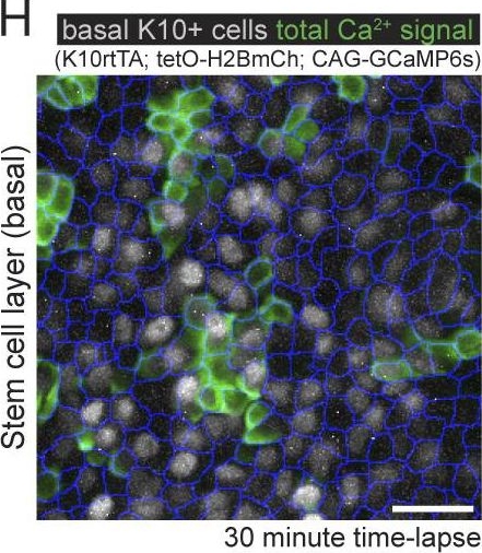 Cell cycle controls long-range calcium signaling in the regenerating epidermis.