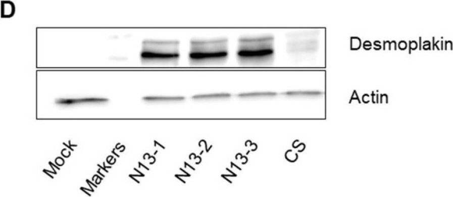 PTPN13 induces cell junction stabilization and inhibits mammary tumor invasiveness.