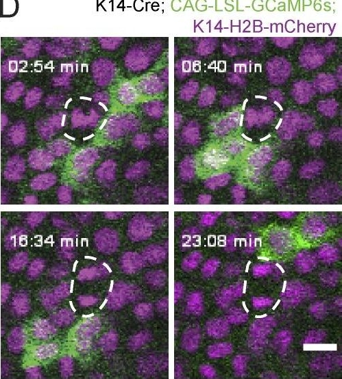 Cell cycle controls long-range calcium signaling in the regenerating epidermis.