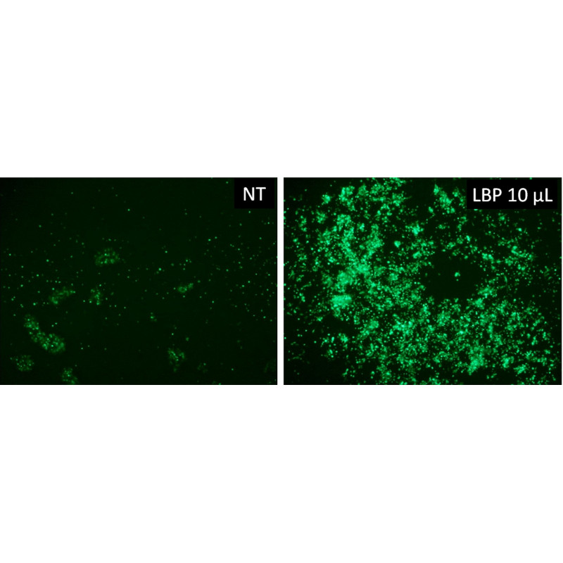 LentiBlast Premium Transduction Enhancer