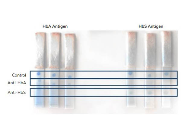 Lateral Flow of Anti-HbA Antibody