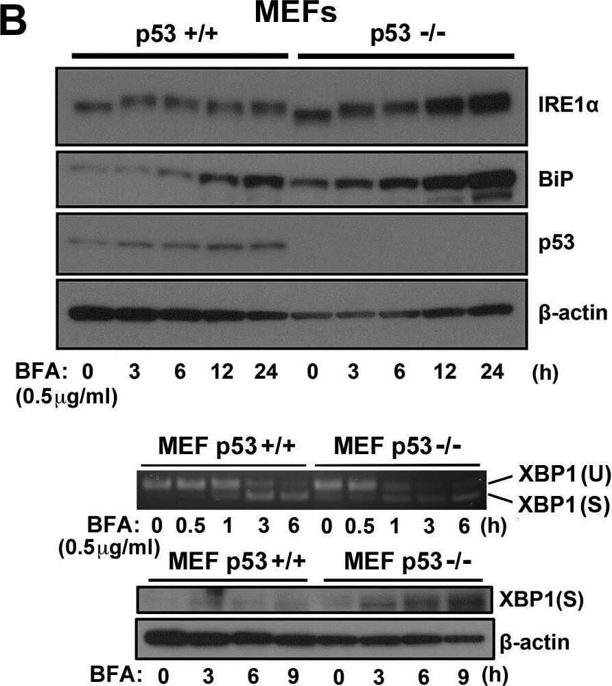 Western Blot using Mouse TrueBlot® ULTRA: Anti-Mouse Ig HRP