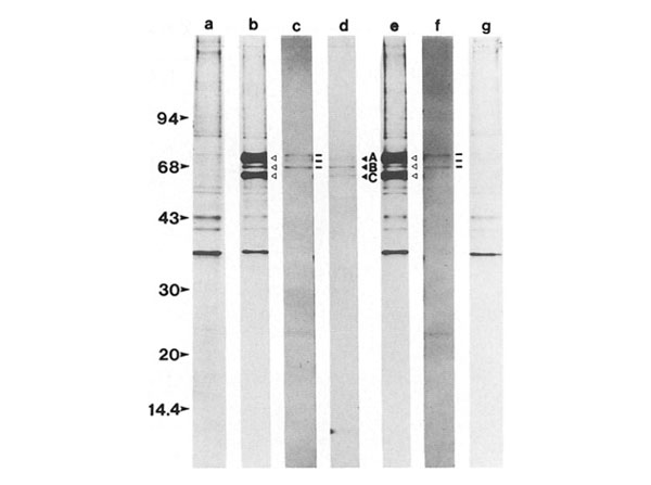 Immunoprecipitation using Guinea Pig Serum