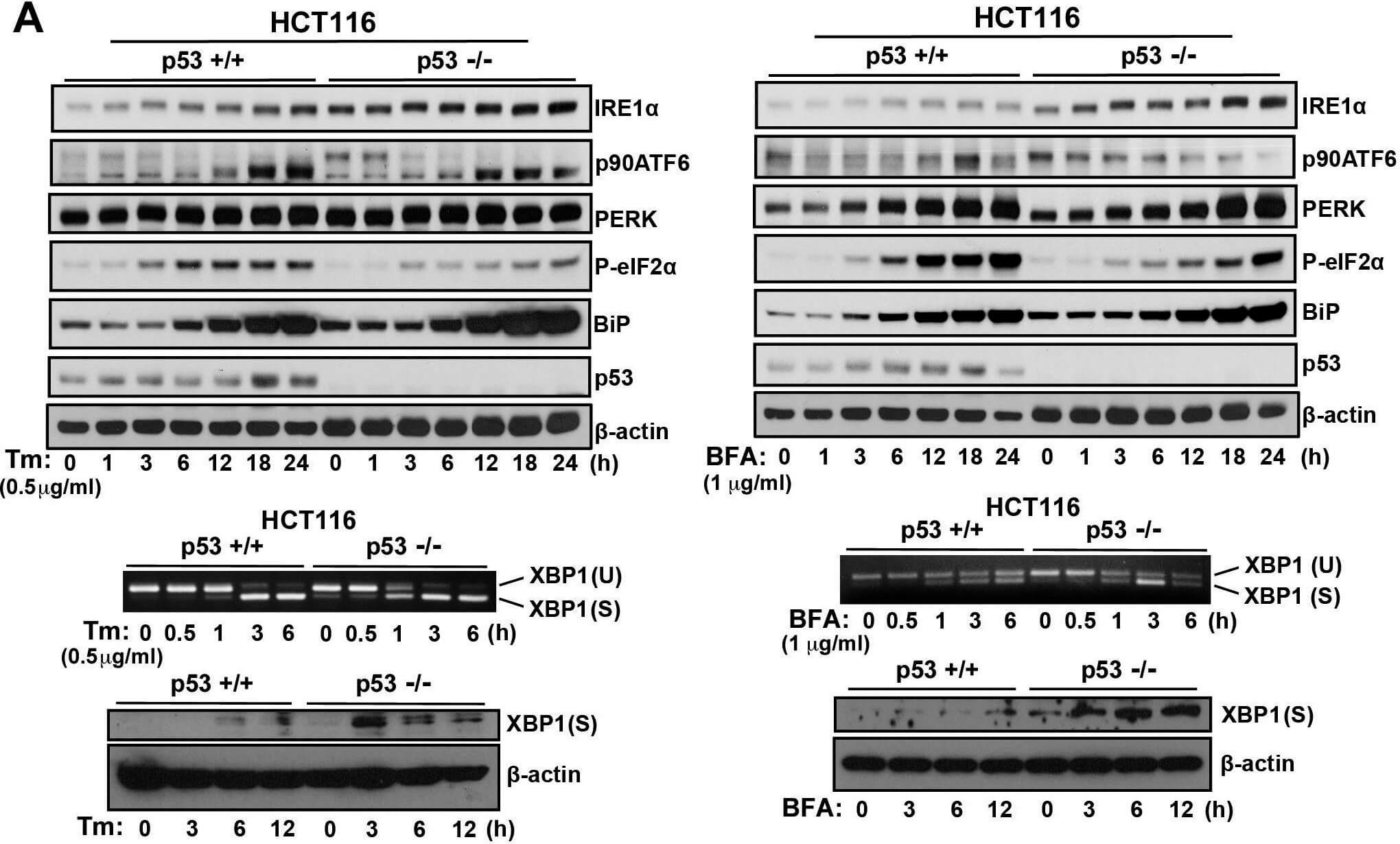 Western Blot using Mouse TrueBlot® ULTRA: Anti-Mouse Ig HRP