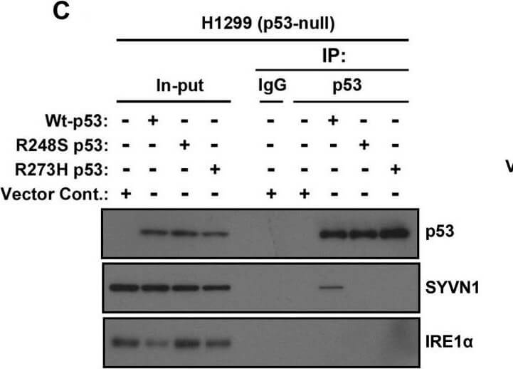 Western Blot using Mouse TrueBlot® ULTRA: Anti-Mouse Ig HRP